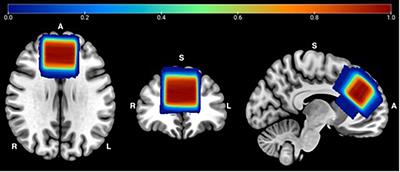 Impact of Transcranial Direct Current Stimulation and Cognitive Training on Frontal Lobe Neurotransmitter Concentrations